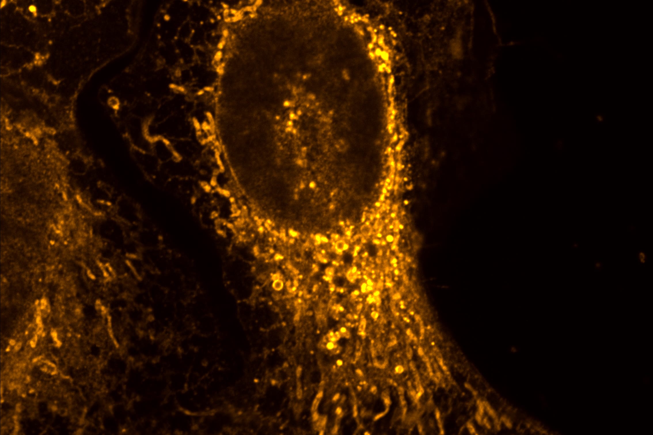 A fluorescence micrograph of a cultured cell. Labelled membranes glow orange against black, brightest in the dense network wrapped around the nucleus.